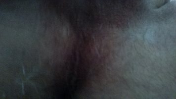 Hairy ass needs u