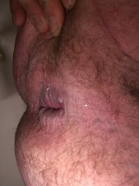 Looking for a hard fat cock to fill this asshole with cock and cum