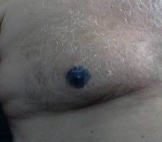Colored nipple