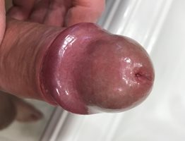 Anyone care for a suck?
