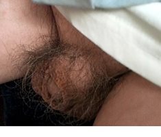my hairy winkled penis early this morning