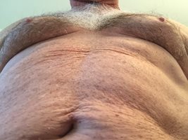 My 72 year old body