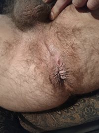 I think my asshole is horribly ugly. Would any of you guys want to play wit...
