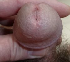 Flashback photo: Close up of my head and piss slit. Love having it licked a...