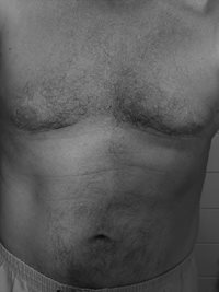 Flashback photo: A shot of my chest, back when I exercised daily
