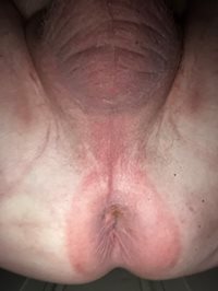 My pink starfish needs reamed and blasted with hot white cum