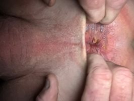 My very small dick .  But spread open pink man hole!  It needs a cock to cu...