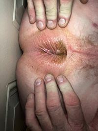My dirty brown bum hole needs a hot man load shot into my man cunt.
