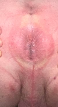 Here’s my red pink purple and brown bummy hole for you boys with a thick un...