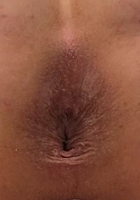 I have a smooth clean hole.  Care to help make it messy?