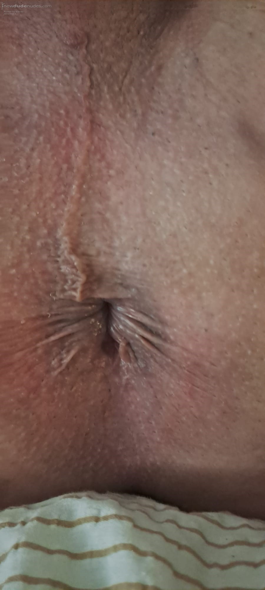Bellybutton or asshole?