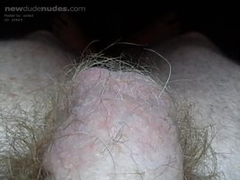 Hairy balls